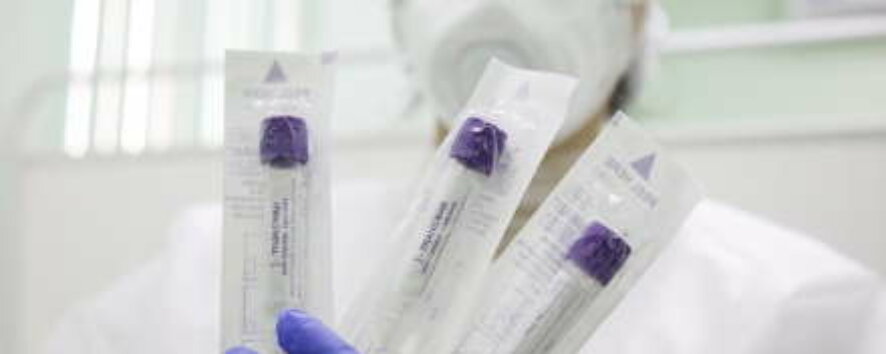 За 18 сентября на территории Республики Крым зарегистрировано 77 случаев коронавирусной инфекции — Сергей Аксенов