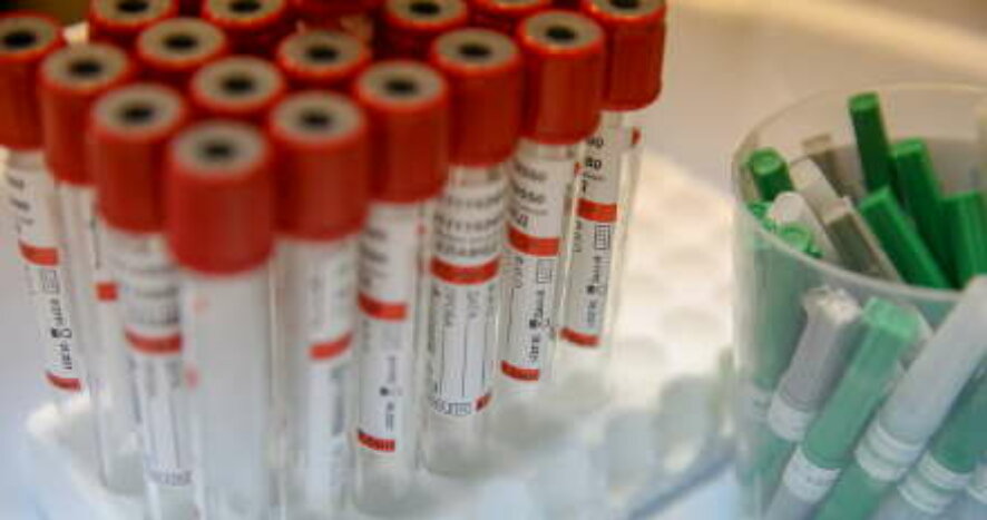 19 ноября в Самарская область подтверждено 218 случаев новой коронавирусной инфекции