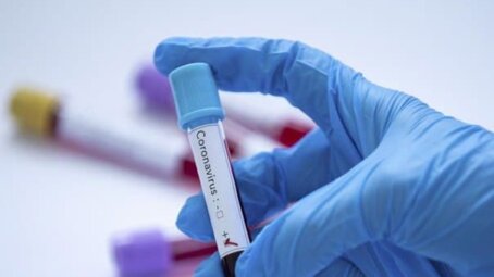Первый случай «Омикрона» выявлен в Калифорнии, на тест ушло менее 30 часов