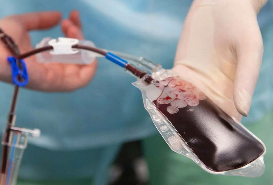 В Петербурге врачи Педиатрического университета сделали внутриутробное переливание крови плоду