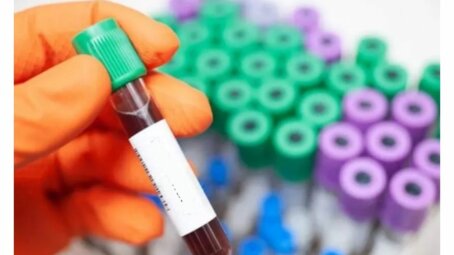 Как пермские ученые превратили кровь в оружие против супербактерий