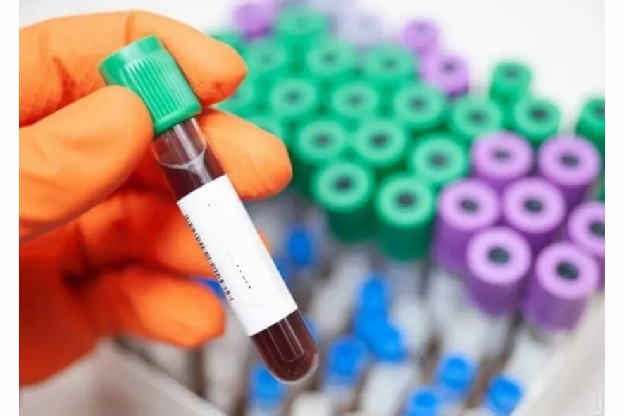 Как пермские ученые превратили кровь в оружие против супербактерий