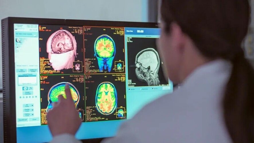 Отложенное взросление: почему ваш мозг остается подростком до 32 лет