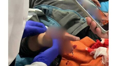 В Красногорске ребенок получил тяжелые ранения при взрыве взрывного устройства, замаскированного под пачку денег